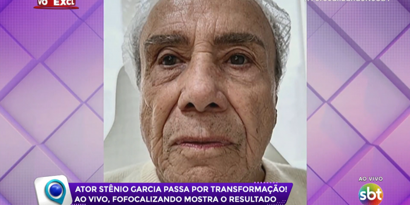 Stenio Garcia harmonização facial